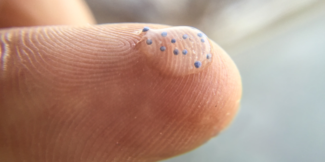 Microplastics in humans