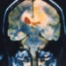 What Can AI Decode From Human Brain Activity?