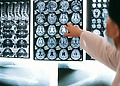 Radiologist pointing at brain MRI scans showing detailed medical examination