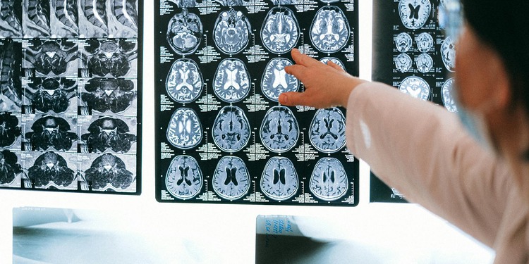 Radiologist pointing at brain MRI scans showing detailed medical examination