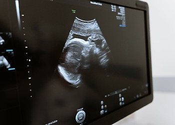 A black and white ultrasound photo on a monitor.